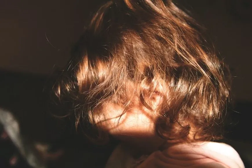Advanced hair restoration treatment for long term postpartum hair loss after pregnancy.