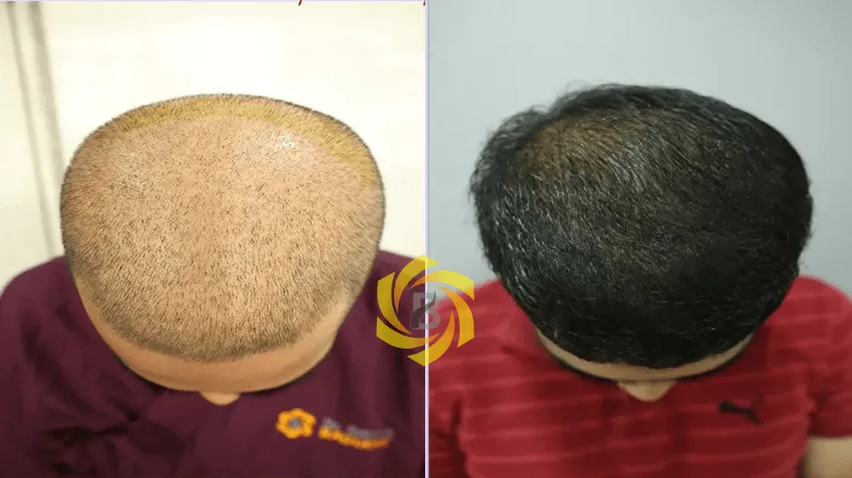 FSCT real life Results